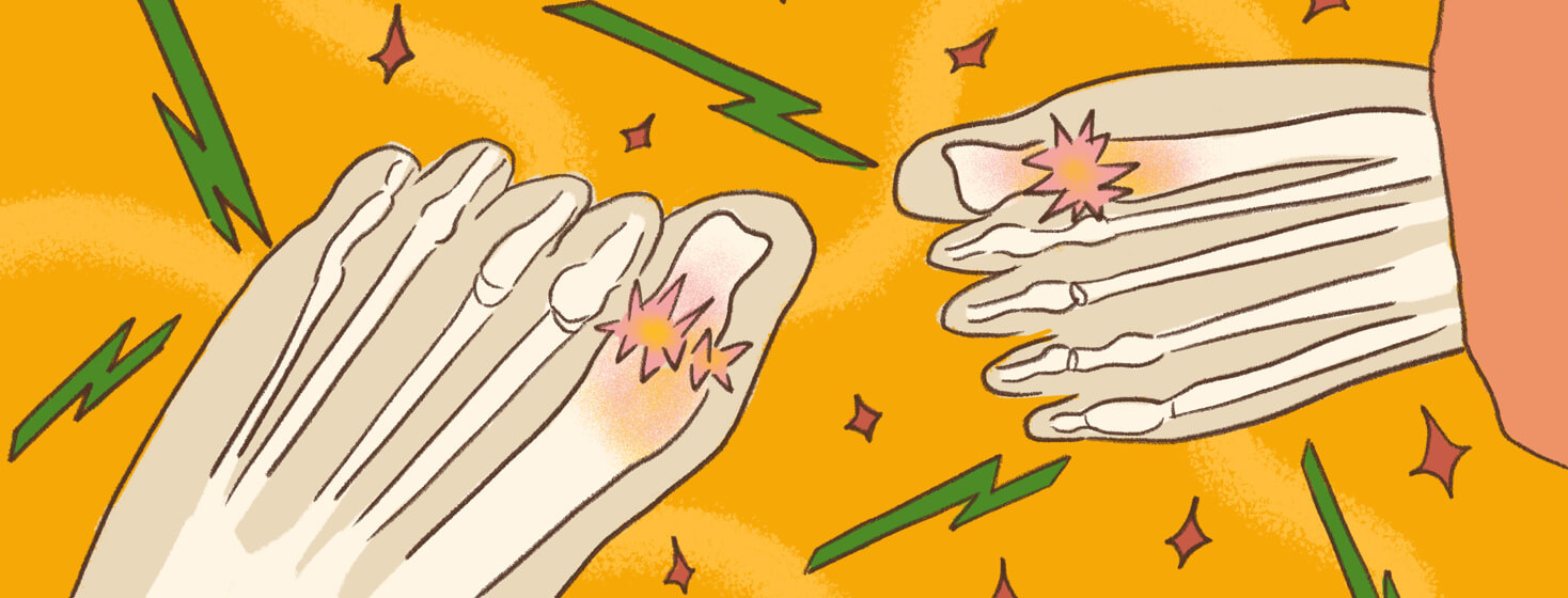 Two feet show pangs of pain; gout is present in the joints of the big toes on each foot.