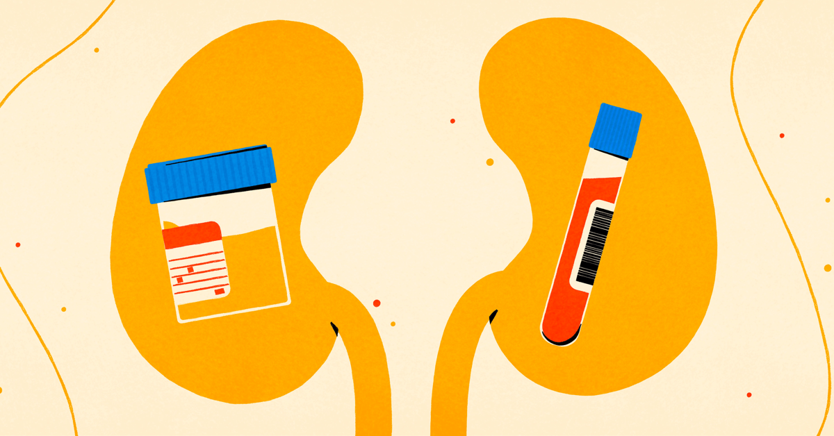 The Essential Kidney Tests for Type 2 Diabetes