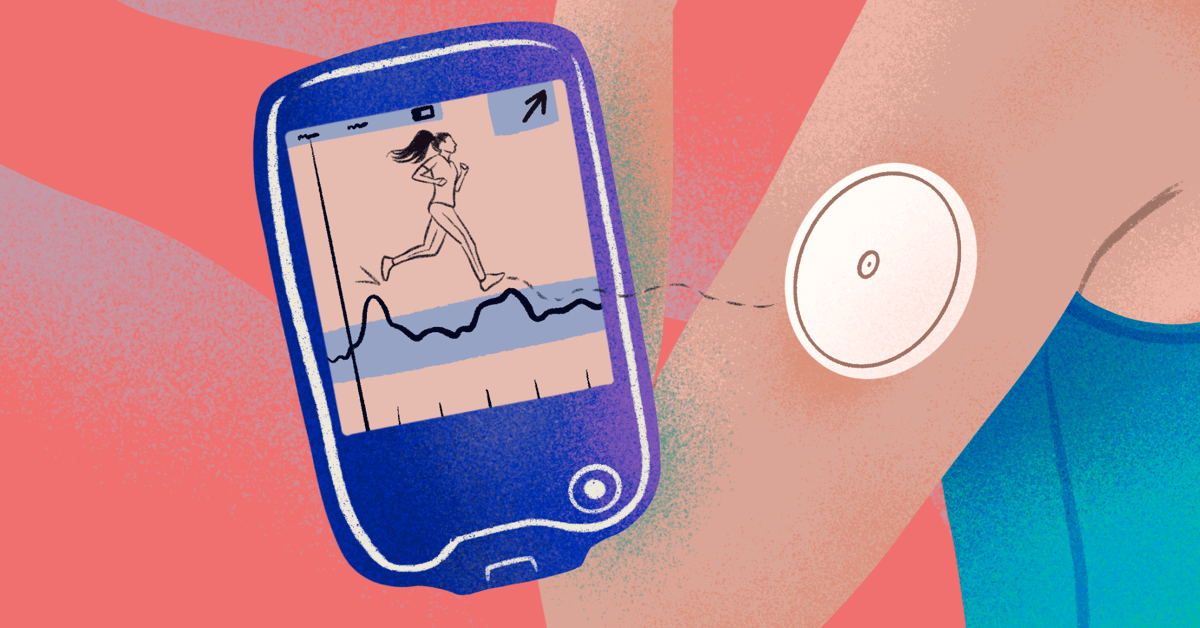 Does Medicare Part B Cover Continuous Glucose Monitors at Genoveva Kivi